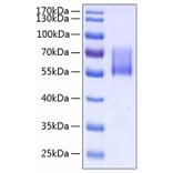 SDS-PAGE - Recombinant Human MUC1 Protein (C-terminal Human Fc and His Tag) (A331074) - Antibodies.com