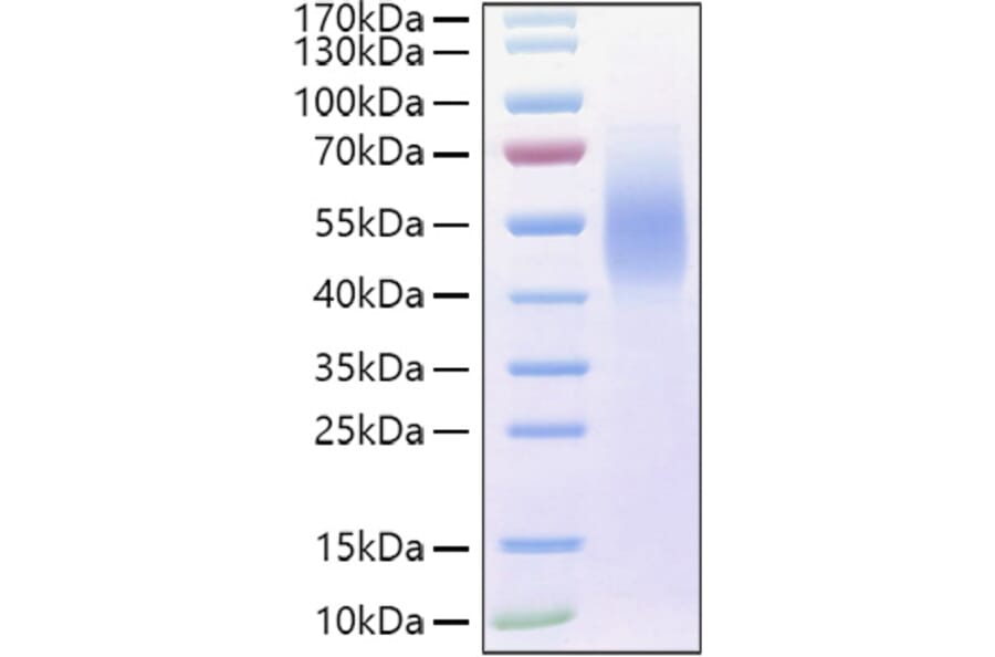 SDS-PAGE - Recombinant Human MUC16 Protein (C-terminal His and Avi Tag) (A331075) - Antibodies.com