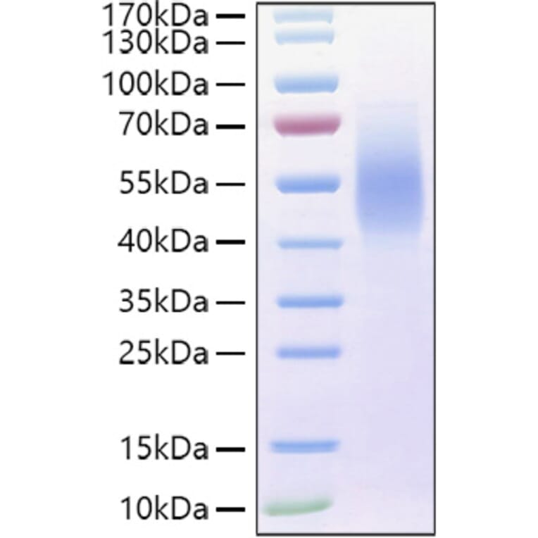 SDS-PAGE - Recombinant Human MUC16 Protein (C-terminal His and Avi Tag) (A331075) - Antibodies.com