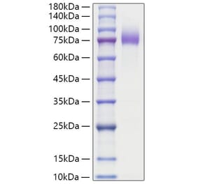 SDS-PAGE - Recombinant Human MUC16 Protein (C-terminal Human Fc Tag) (A331076) - Antibodies.com