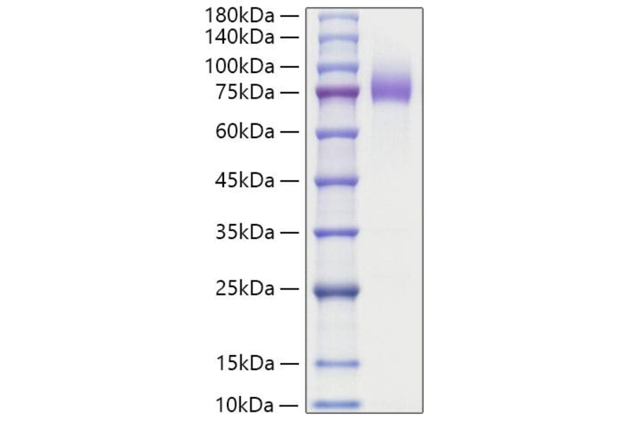SDS-PAGE - Recombinant Human MUC16 Protein (C-terminal Human Fc Tag) (A331076) - Antibodies.com