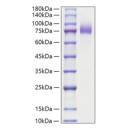 SDS-PAGE - Recombinant Human MUC16 Protein (C-terminal Human Fc Tag) (A331076) - Antibodies.com