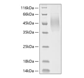 SDS-PAGE - Recombinant Human MUC16 Protein (C-terminal His Tag) (A331077) - Antibodies.com