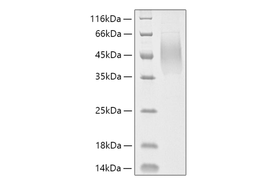 SDS-PAGE - Recombinant Human MUC16 Protein (C-terminal His Tag) (A331077) - Antibodies.com