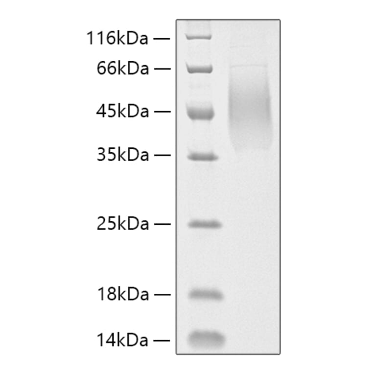 SDS-PAGE - Recombinant Human MUC16 Protein (C-terminal His Tag) (A331077) - Antibodies.com