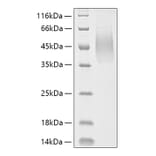 SDS-PAGE - Recombinant Human MUC16 Protein (C-terminal His Tag) (A331077) - Antibodies.com