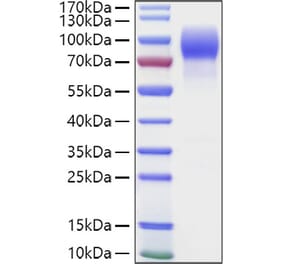 SDS-PAGE - Recombinant Human MUC16 Protein (C-terminal Human Fc and Avi Tag) (A331078) - Antibodies.com