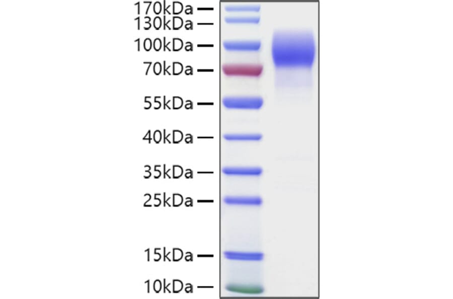 SDS-PAGE - Recombinant Human MUC16 Protein (C-terminal Human Fc and Avi Tag) (A331078) - Antibodies.com
