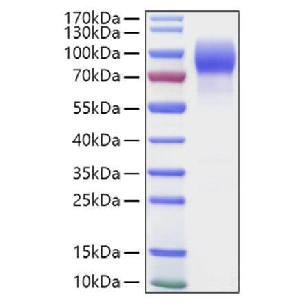 SDS-PAGE - Recombinant Human MUC16 Protein (C-terminal Human Fc and Avi Tag) (A331078) - Antibodies.com
