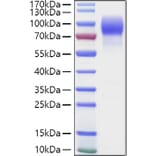 SDS-PAGE - Recombinant Human MUC16 Protein (C-terminal Human Fc and Avi Tag) (A331078) - Antibodies.com