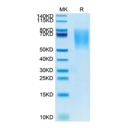 Tris-Bis PAGE - Recombinant Human MUC16 Protein (Biotin) (C-terminal His and Avi Tag) (A331079) - Antibodies.com