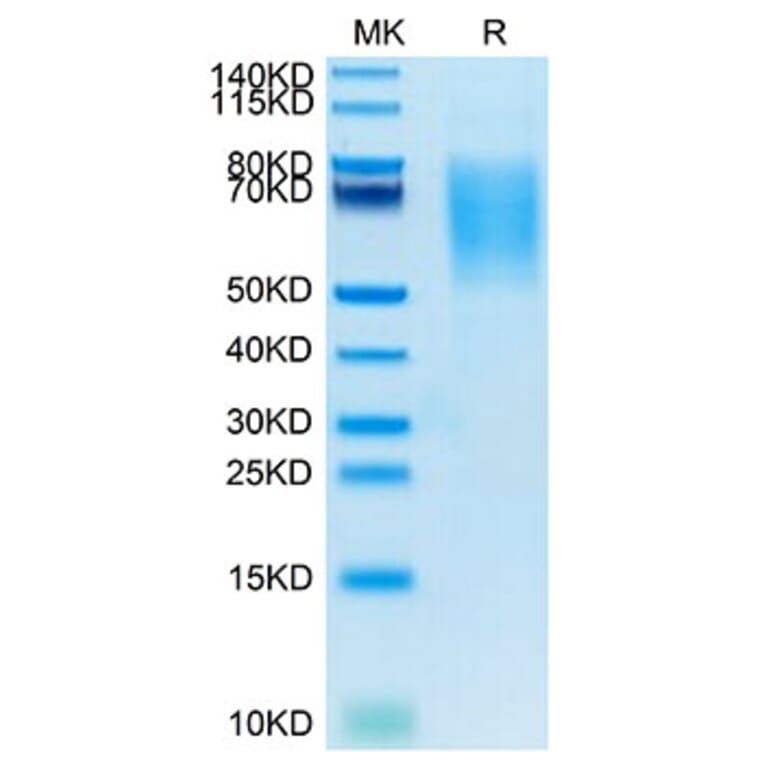 Tris-Bis PAGE - Recombinant Human MUC16 Protein (Biotin) (C-terminal His and Avi Tag) (A331079) - Antibodies.com