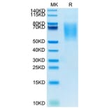 Tris-Bis PAGE - Recombinant Human MUC16 Protein (Biotin) (C-terminal His and Avi Tag) (A331079) - Antibodies.com