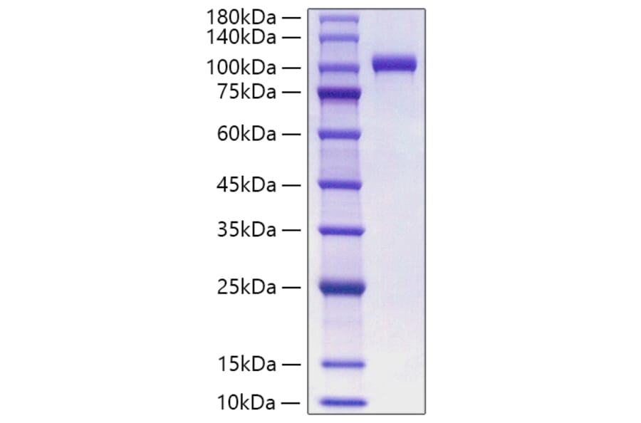 SDS-PAGE - Recombinant Human Myeloperoxidase Protein (C-terminal His Tag) (A331080) - Antibodies.com