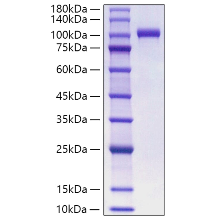 SDS-PAGE - Recombinant Human Myeloperoxidase Protein (C-terminal His Tag) (A331080) - Antibodies.com