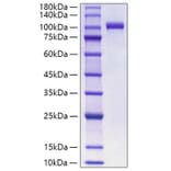 SDS-PAGE - Recombinant Human Myeloperoxidase Protein (C-terminal His Tag) (A331080) - Antibodies.com