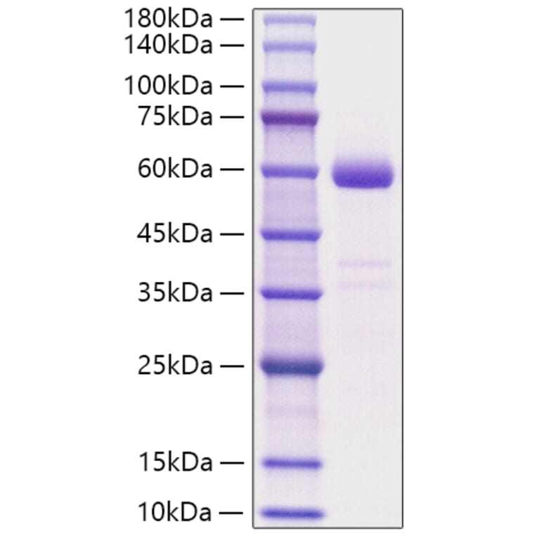 SDS-PAGE - Recombinant Human NBL1 Protein (C-terminal Human Fc Tag) (A331081) - Antibodies.com