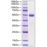 SDS-PAGE - Recombinant Human NBL1 Protein (C-terminal Human Fc Tag) (A331081) - Antibodies.com