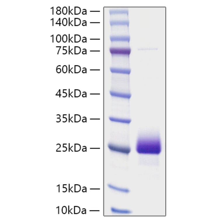 SDS-PAGE - Recombinant Human NBL1 Protein (C-terminal His Tag) (A331082) - Antibodies.com