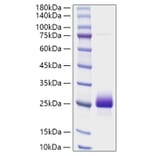 SDS-PAGE - Recombinant Human NBL1 Protein (C-terminal His Tag) (A331082) - Antibodies.com