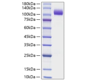 SDS-PAGE - Recombinant Human NCAM1 Protein (C-terminal His Tag) (A331083) - Antibodies.com