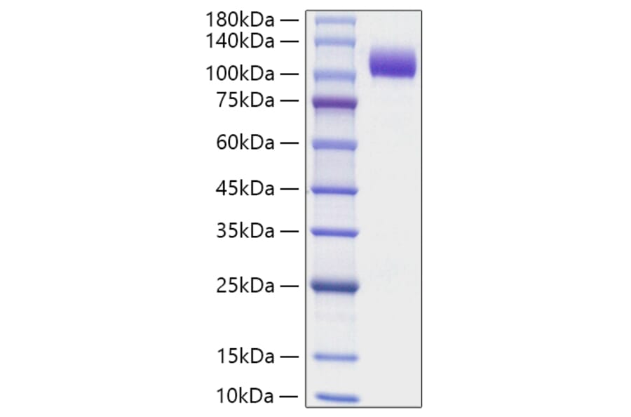 SDS-PAGE - Recombinant Human NCAM1 Protein (C-terminal His Tag) (A331083) - Antibodies.com
