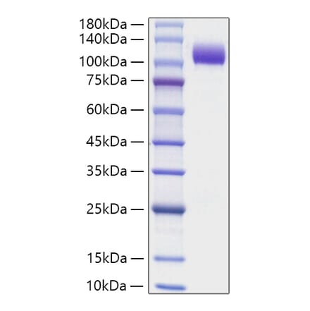 SDS-PAGE - Recombinant Human NCAM1 Protein (C-terminal His Tag) (A331083) - Antibodies.com