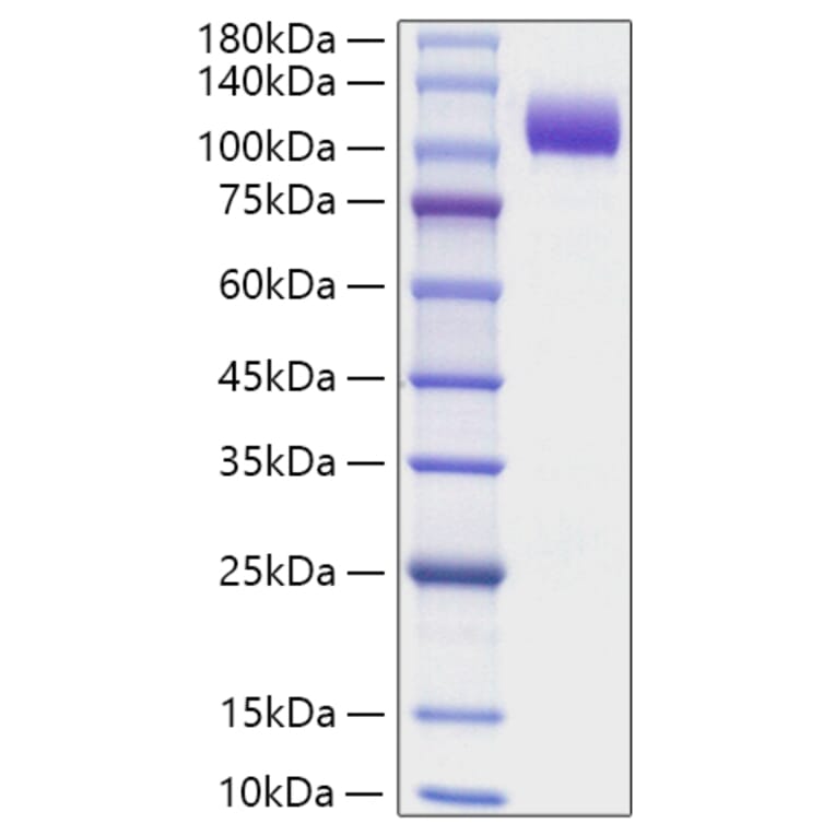 SDS-PAGE - Recombinant Human NCAM1 Protein (C-terminal His Tag) (A331083) - Antibodies.com