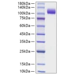 SDS-PAGE - Recombinant Human NCAM1 Protein (C-terminal His Tag) (A331083) - Antibodies.com