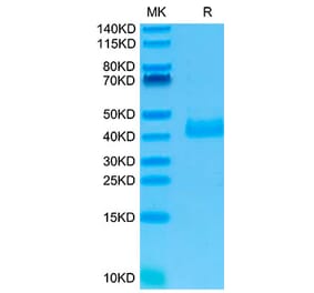 Tris-Bis PAGE - Recombinant Human NCR1 Protein (N-terminal His Tag) (A331085) - Antibodies.com