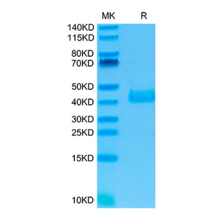 Tris-Bis PAGE - Recombinant Human NCR1 Protein (N-terminal His Tag) (A331085) - Antibodies.com