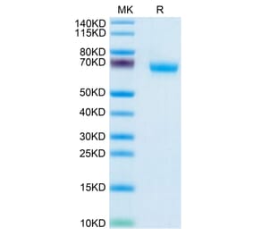 Tris-Bis PAGE - Recombinant Human NCR1 Protein (C-terminal Human Fc Tag) (A331086) - Antibodies.com
