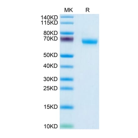 Tris-Bis PAGE - Recombinant Human NCR1 Protein (C-terminal Human Fc Tag) (A331086) - Antibodies.com