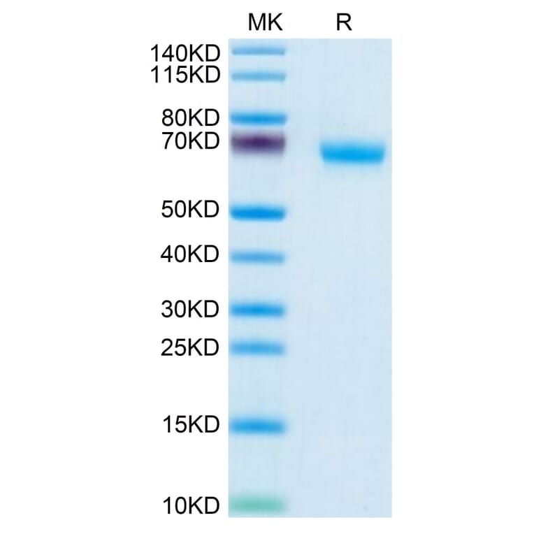 Tris-Bis PAGE - Recombinant Human NCR1 Protein (C-terminal Human Fc Tag) (A331086) - Antibodies.com