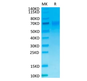 Tris-Bis PAGE - Recombinant Human NCR1 Protein (C-terminal Mouse Fc Tag) (A331087) - Antibodies.com