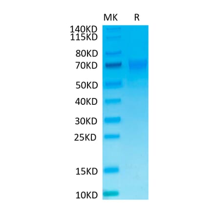 Tris-Bis PAGE - Recombinant Human NCR1 Protein (C-terminal Mouse Fc Tag) (A331087) - Antibodies.com