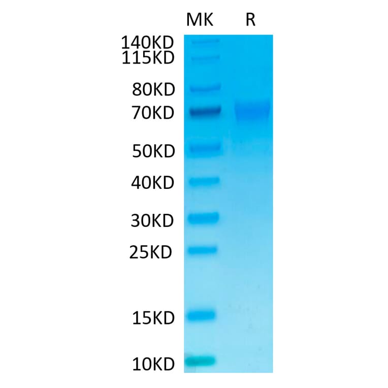 Tris-Bis PAGE - Recombinant Human NCR1 Protein (C-terminal Mouse Fc Tag) (A331087) - Antibodies.com