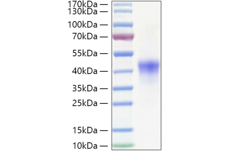 SDS-PAGE - Recombinant Human NDRG1 Protein (C-terminal His Tag) (A331088) - Antibodies.com