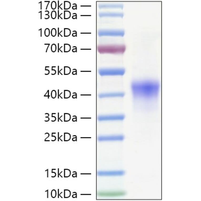 SDS-PAGE - Recombinant Human NDRG1 Protein (C-terminal His Tag) (A331088) - Antibodies.com