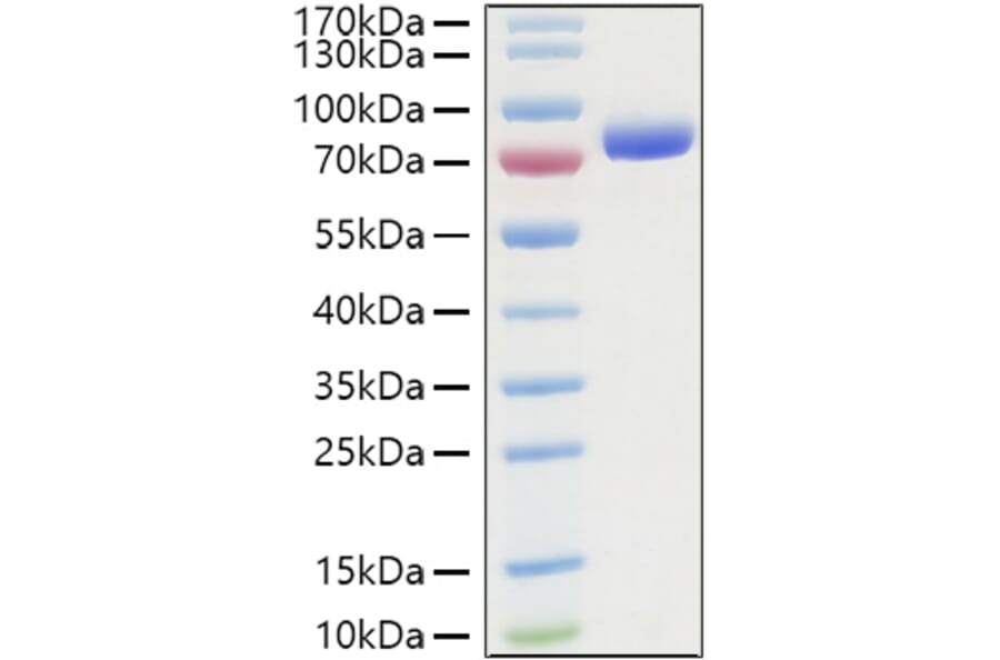 SDS-PAGE - Recombinant Human Nectin 2 Protein (C-terminal Human Fc and His Tag) (A331089) - Antibodies.com