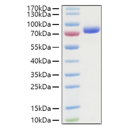 SDS-PAGE - Recombinant Human Nectin 2 Protein (C-terminal Human Fc and His Tag) (A331089) - Antibodies.com