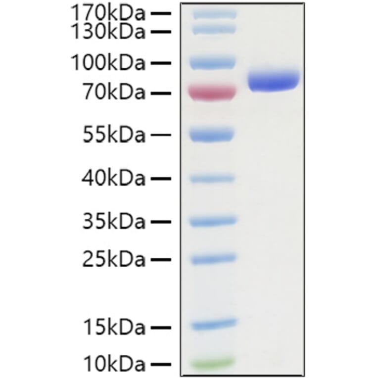 SDS-PAGE - Recombinant Human Nectin 2 Protein (C-terminal Human Fc and His Tag) (A331089) - Antibodies.com