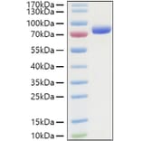 SDS-PAGE - Recombinant Human Nectin 2 Protein (C-terminal Human Fc and His Tag) (A331089) - Antibodies.com