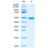 Tris-Bis PAGE - Recombinant Human Nectin 2 Protein (A331091) - Antibodies.com