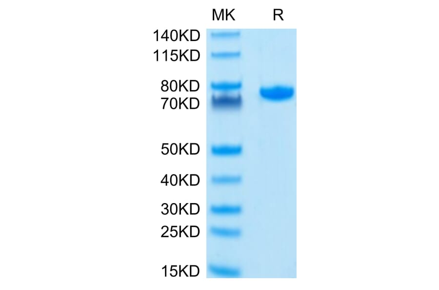 Tris-Bis PAGE - Recombinant Human Nectin 2 Protein (C-terminal Human Fc Tag) (A331093) - Antibodies.com