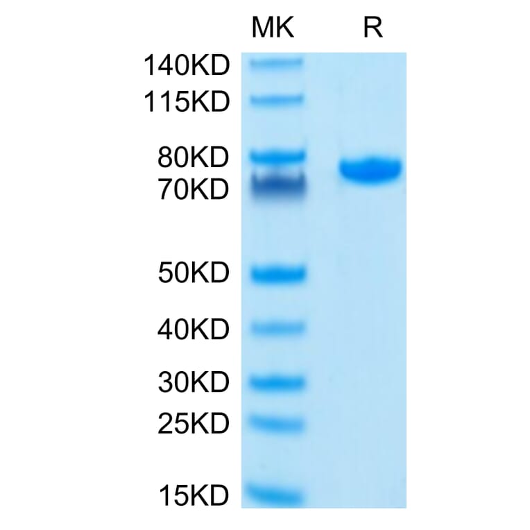 Tris-Bis PAGE - Recombinant Human Nectin 2 Protein (C-terminal Human Fc Tag) (A331093) - Antibodies.com