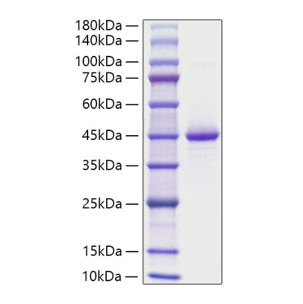 SDS-PAGE - Recombinant Human Neurogranin Protein (C-terminal Human Fc Tag) (A331096) - Antibodies.com