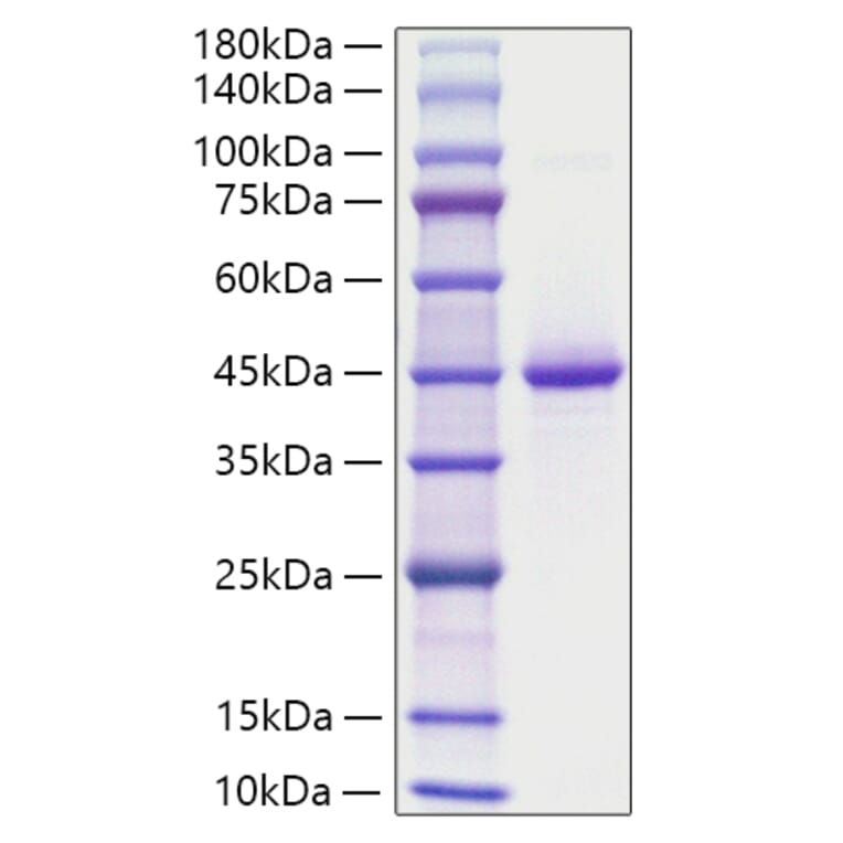 SDS-PAGE - Recombinant Human Neurogranin Protein (C-terminal Human Fc Tag) (A331096) - Antibodies.com