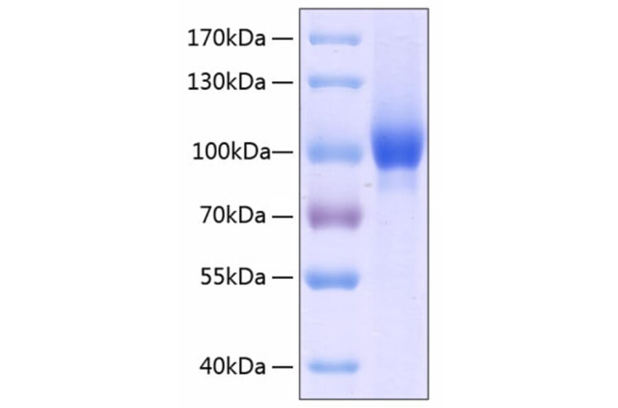 SDS-PAGE - Recombinant Human Neuropilin-1 Protein (C-terminal His Tag) (A331097) - Antibodies.com