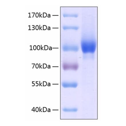 SDS-PAGE - Recombinant Human Neuropilin-1 Protein (C-terminal His Tag) (A331097) - Antibodies.com